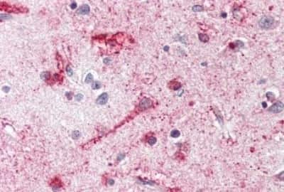 Immunohistochemistry-Paraffin: Melanocortin-4 R Antibody [NBP3-14398]